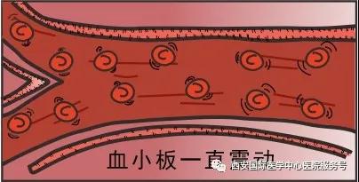 血小板是正常值的三倍？專家提醒小心血栓和出血！