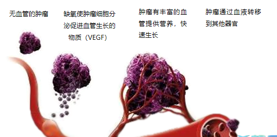 晚期腫瘤為什么會復(fù)發(fā)轉(zhuǎn)移？