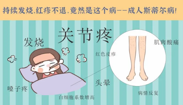 持續(xù)發(fā)燒、紅疹不退……她終于在這里治好了這個(gè)罕見病