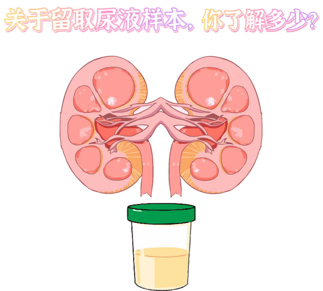 做尿檢，不得不說的注意事項(xiàng)！
