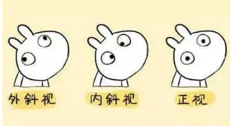 小baby老歪著頭？警惕斜頸! 這樣糾正……