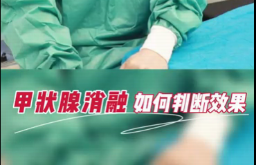 甲狀腺消融如何判斷效果？