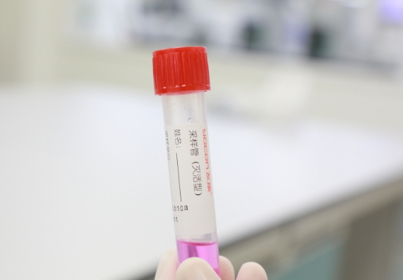 支原體感染檢測手段知多少？