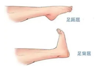 扭胯小連步、動(dòng)感搖花手……“科目三”雖火，運(yùn)動(dòng)損傷也要防！